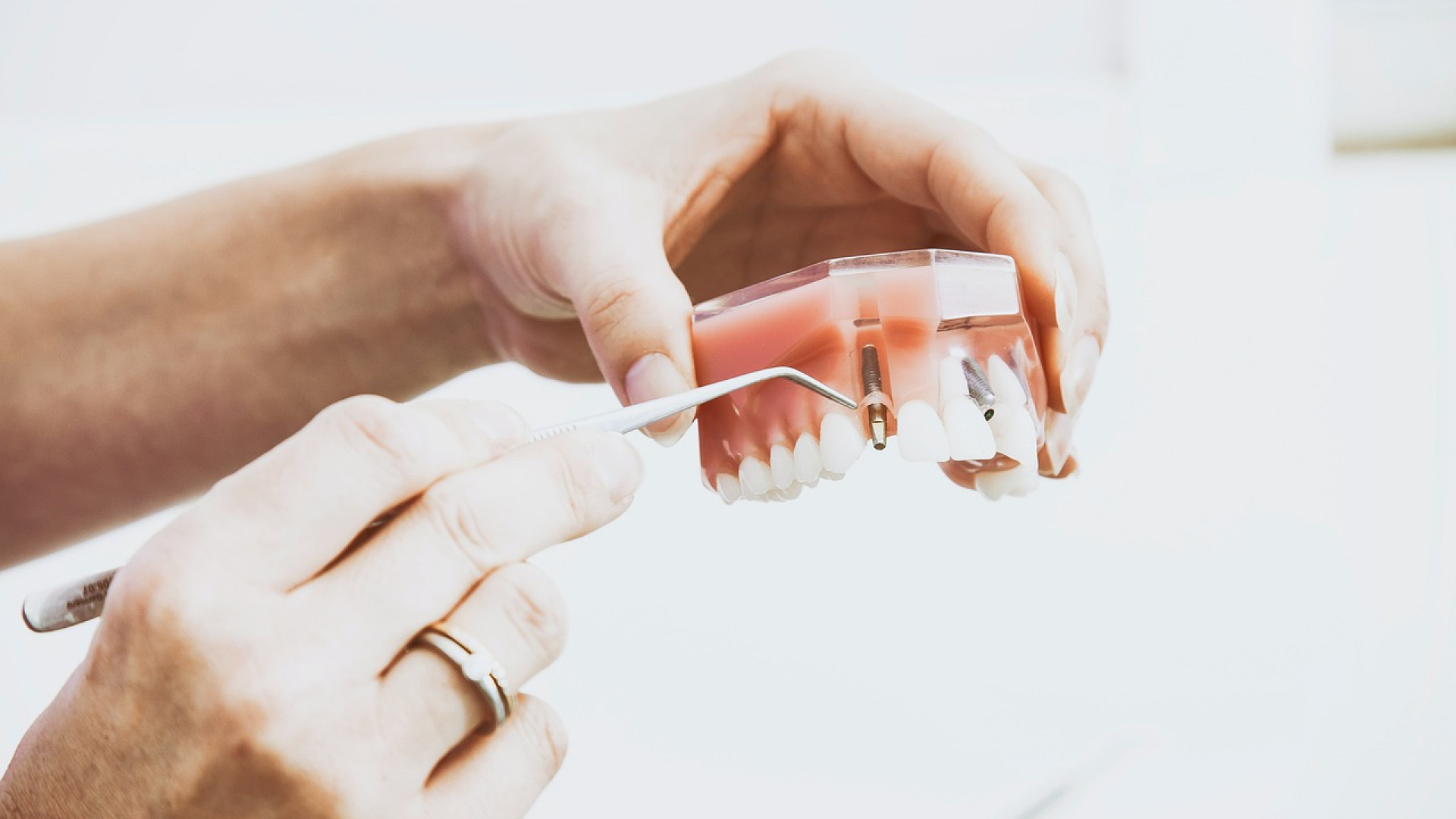 Cabinet spécialiste dans les inventions dentaires : quelles sont les urgences recevables ?